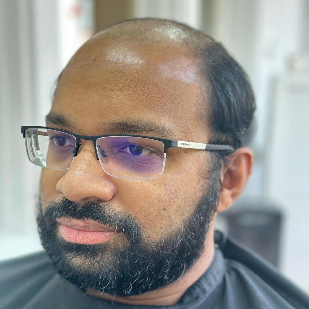 Kunde mit dünnem Haar vor der Anwendung eines Haarsystems