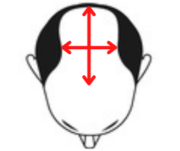 1. Länge und Breite messen bzw. Haarsystem einschicken