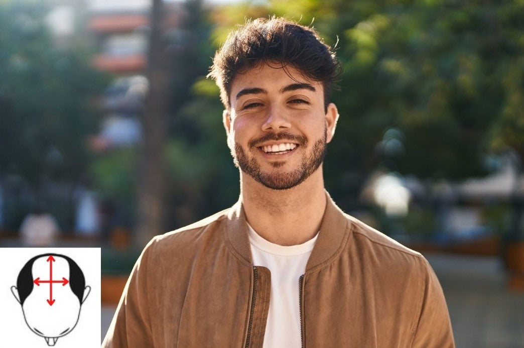 Mann mit Haarsystem aus Remy-Haar