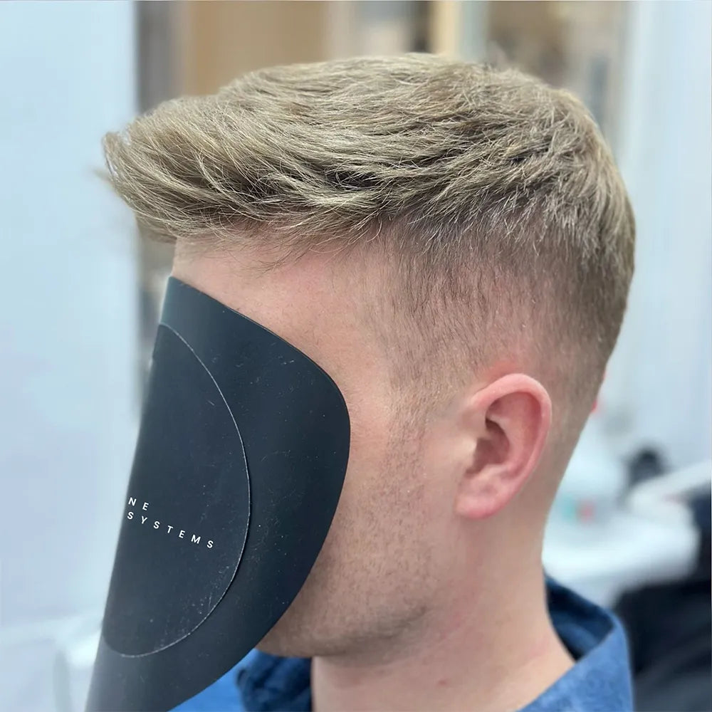 Junger Mann mit Haarsystem und neuer Haarfülle