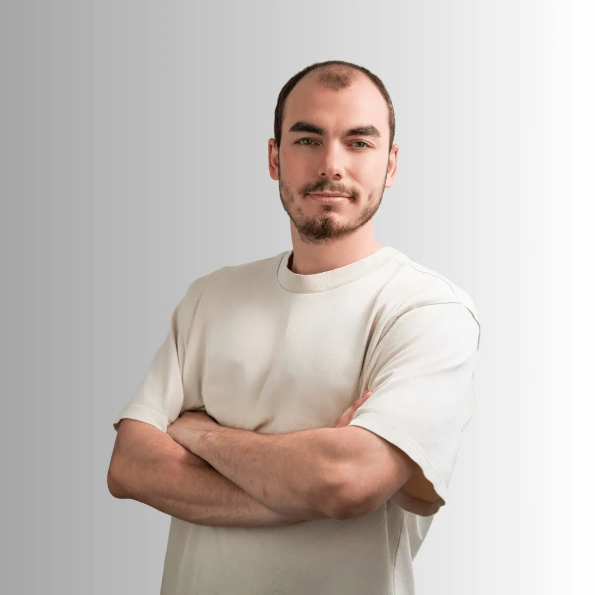 Kunde vor Anwendung eines Haarsystems, lichte Haare am Oberkopf