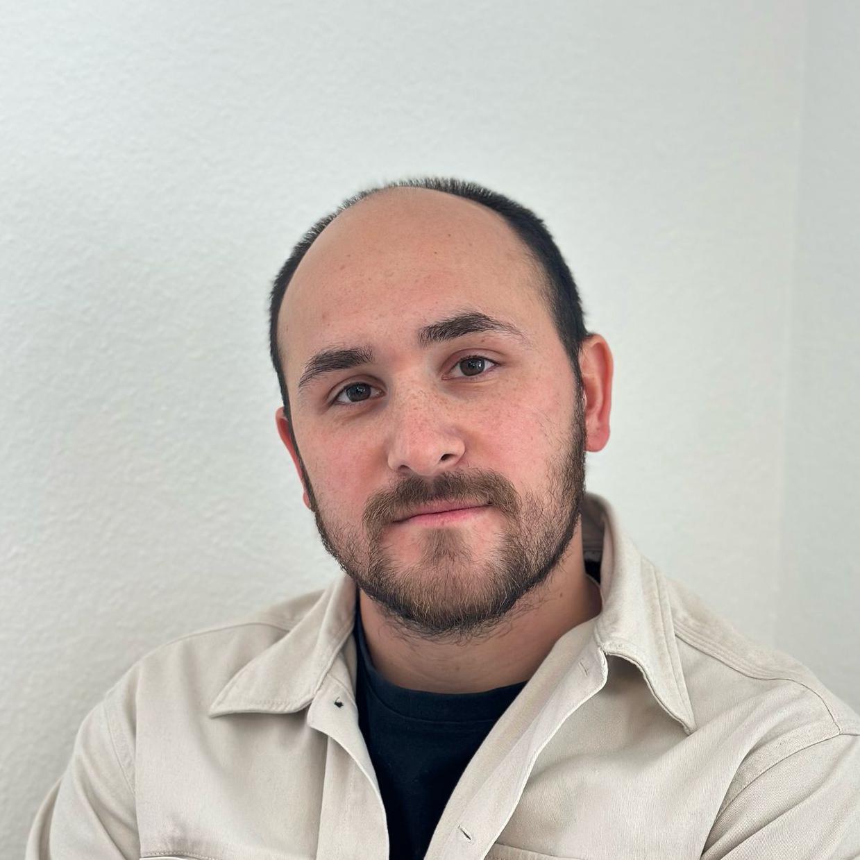 Kunde vor dem Tragen eines Haarsystems, Haarausfall am Oberkopf