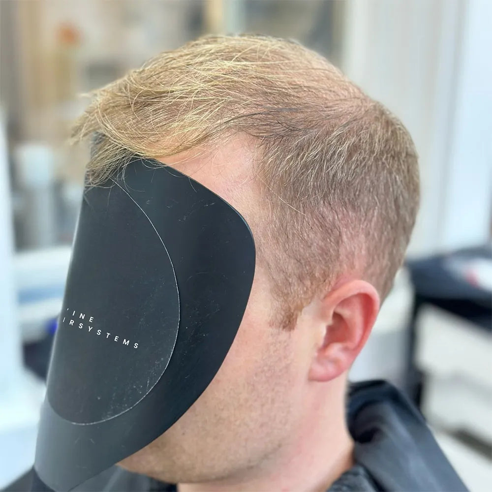 kunde vor dem Haarsystem von divine hairsystems 